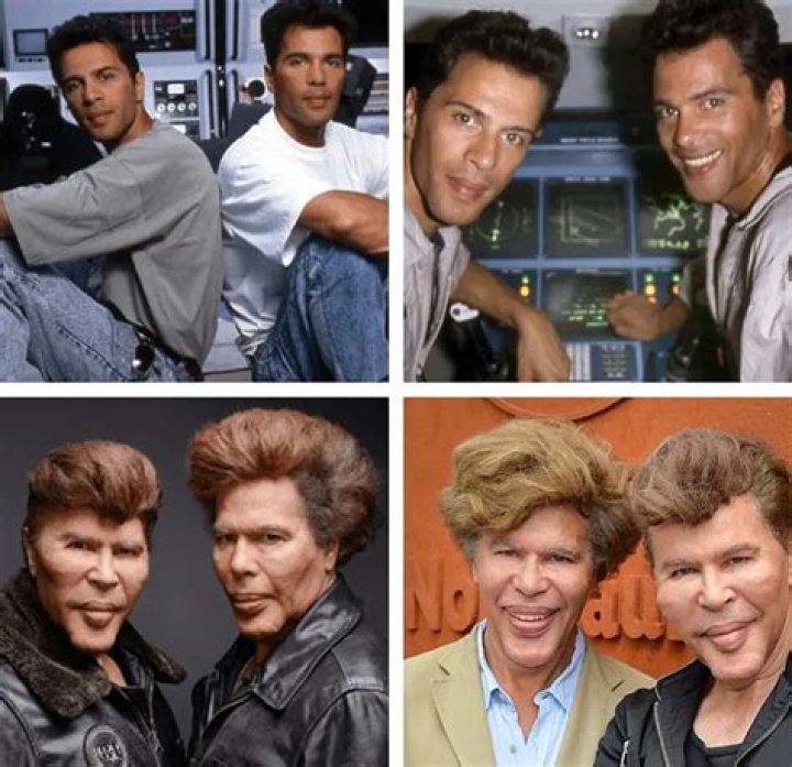 Plastic Surgery Twins: A Journey Of Transformation